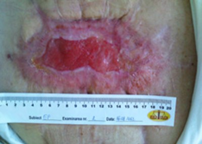 Fig. 3 B Cicatrizare B